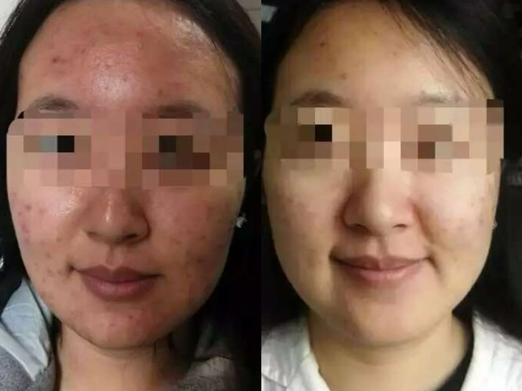 使用前後對比(未修圖)