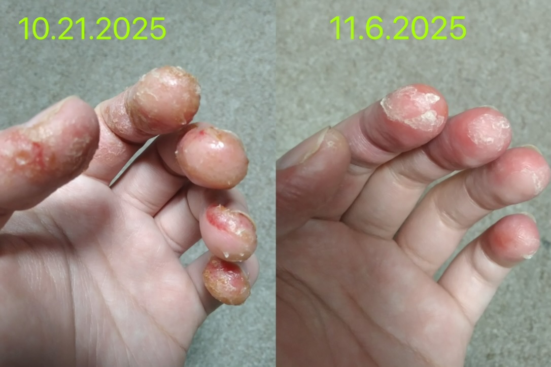 使用前後對比(未修圖)